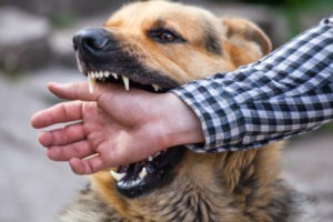 Why do I need a dog bite lawyer?